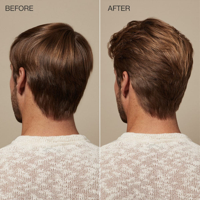 Tea Tree Scalp Care Regeniplex before and after comparison