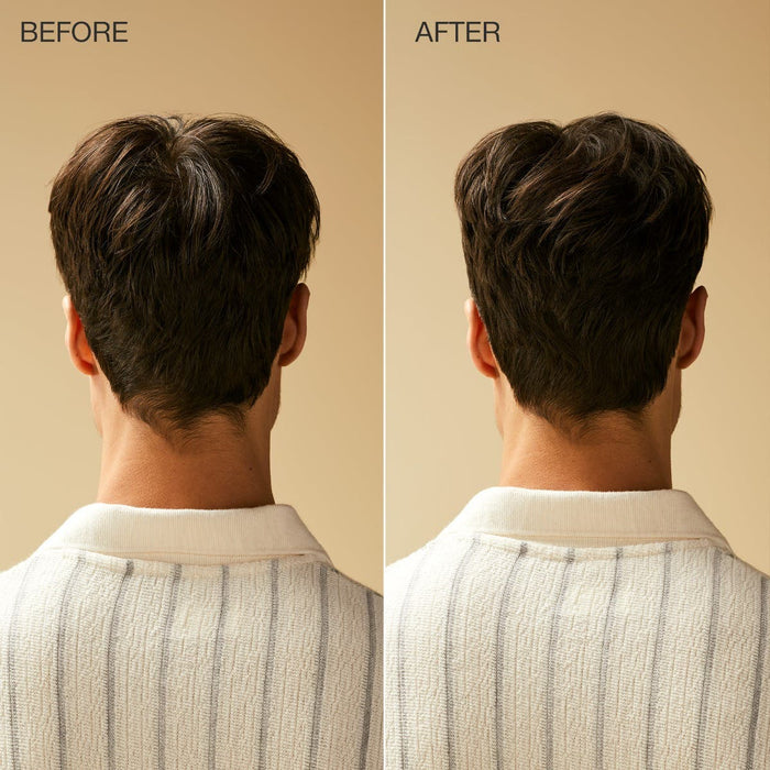 Tea Tree Forming Cream model before and after comparison