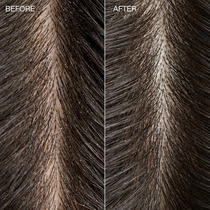 Close-up before and after comparison of the scalp